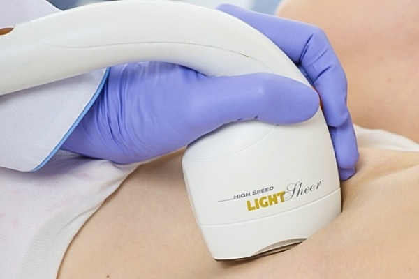 depilacja laserowa light speer